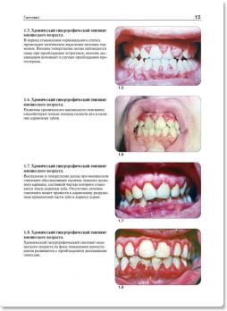 Атлас по стоматологическим заболеваниям у детей (Т.Ф. Виноградова) 2010 г.