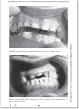 Функциональная окклюзия: от височно-нижнечелюстного сустава до планирования улыбки (Питер Е. Доусон)