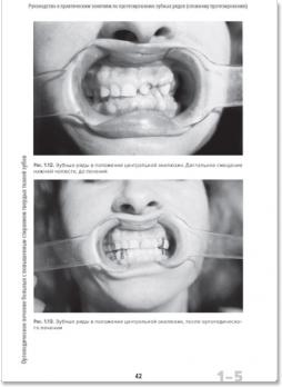 Функциональная окклюзия: от височно-нижнечелюстного сустава до планирования улыбки (Питер Е. Доусон)