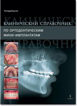 Клинический справочник по ортодонтическим мини-имплантатам (Ричард Р. Дж. Коусли (Richard R. J. Cousley)) 2014 г.