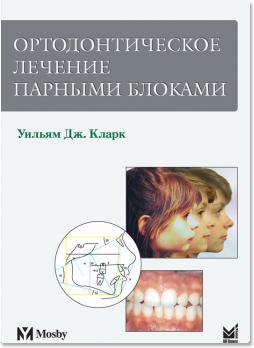 Ортодонтическое лечение парными блоками (Уильям Дж. Кларк (William J. Clark)) 2007 г.
