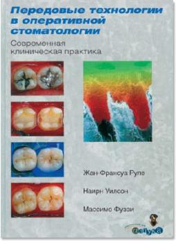 Передовые технологии в оперативной стоматологии (Жан-Франсуа Руле, Наирн Уилсон, Массимо Фуззи) 2006 г.