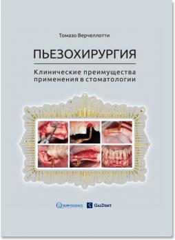 Пьезохирургия. Клинические преимущества применения в стоматологии (Томазо Варчелотти (Tomaso Vercellotti)) 2013 г.