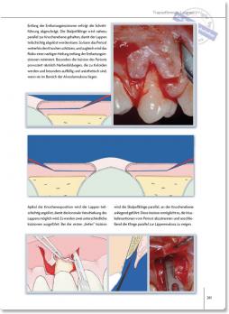 Пластическая хирургия мягких тканей полости рта (Джованни Зуккелли) 2014 г.