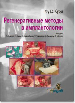Регенеративные методы в имплантологии (Фуад Кури (Fouad Khoury) и соавт.) 2013 г.