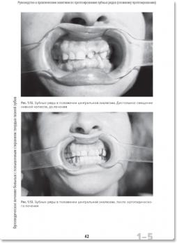 Руководство к практическим занятиям по протезированию зубных рядов (сложному протезированию) (Лебеденко И.Ю.) 2014 г.