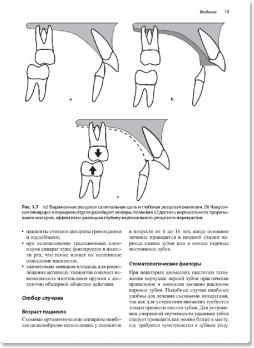 Съёмные ортодонтические аппараты (К.Г. Исааксон, Дж.Д. Мюр, Р.Т. Рид) 2012 г.