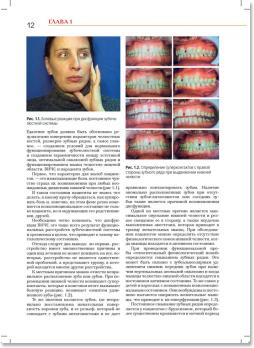 Стоматология. Нейростоматология. Дисфункции зубочелюстной системы (Л.С. Персин, М.Н. Шаров) 2013 г.