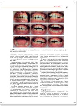 Стоматология. Нейростоматология. Дисфункции зубочелюстной системы (Л.С. Персин, М.Н. Шаров) 2013 г.