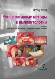 Регенеративные методы в имплантологии (Фуад Кури (Fouad Khoury) и соавт.) 2013 г.